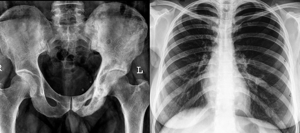 X-Ray