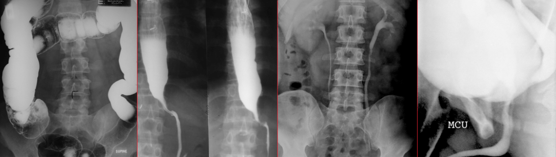 X-ray-procedure - 1