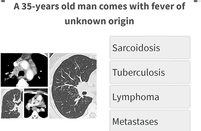 Quiz