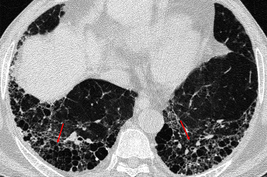 CT-Scan-Service