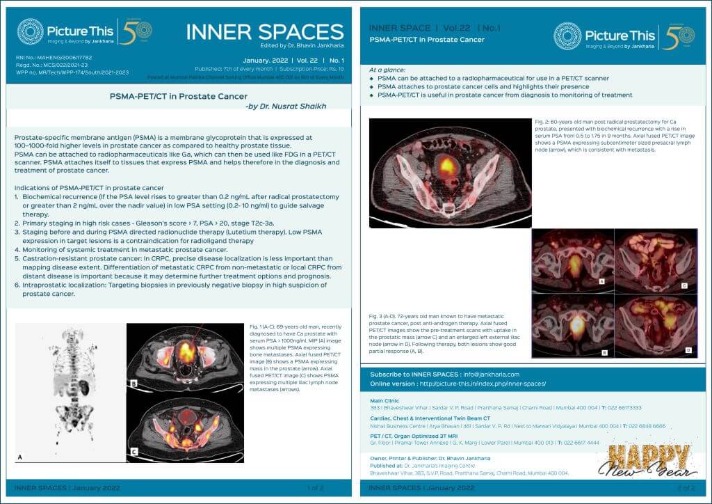 psma-pet-ct-in-prostate-cancer