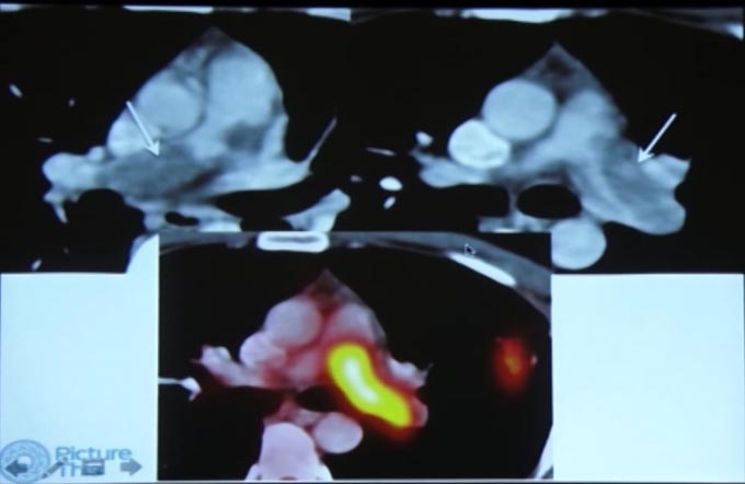 Chest Radiology - Interesting Cases - Part I