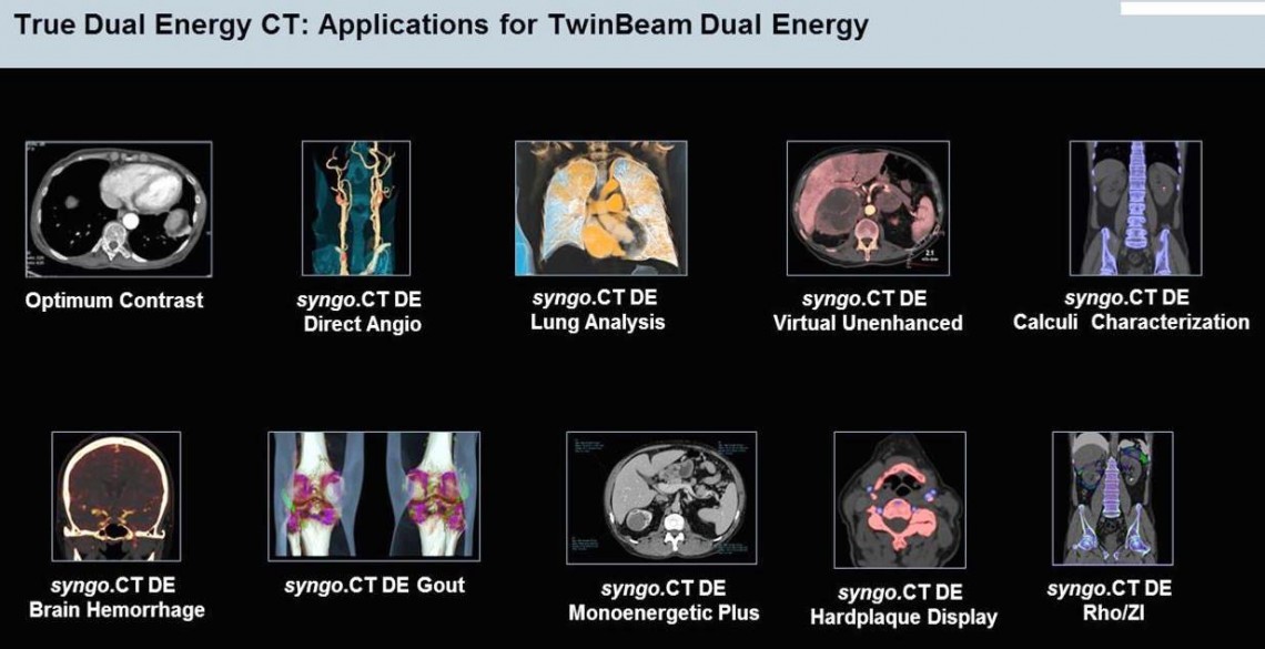 True Dual Energy CT