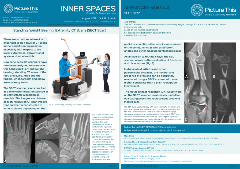aug-18-standing-weight-bearing-extremity-ct-scans-sect-scan