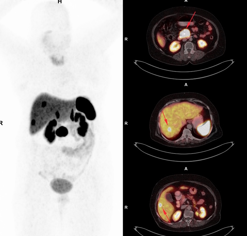 dota-pet-scan