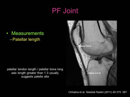 Slide22
