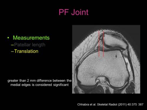 Slide23