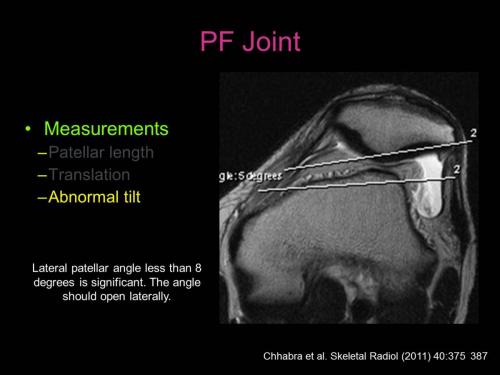 Slide24