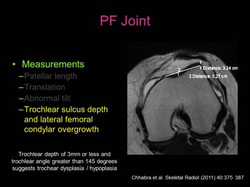 Slide25