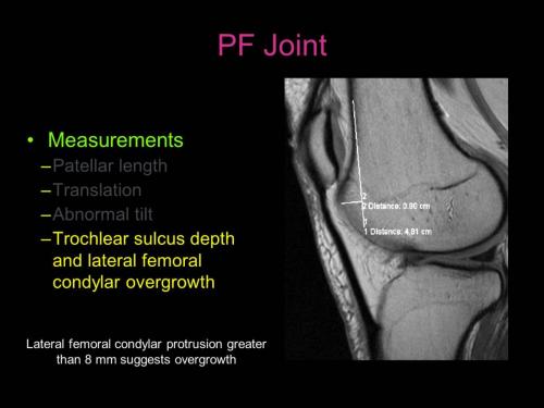 Slide26