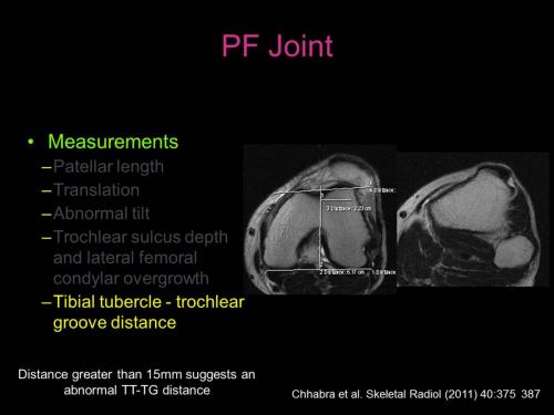 Slide27