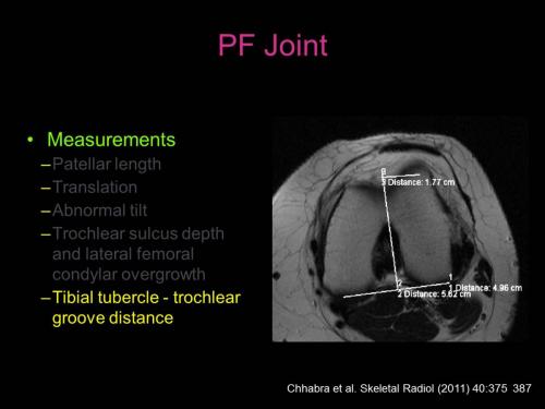 Slide28