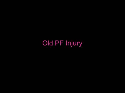 Slide30