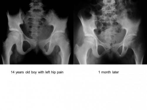 Slide5