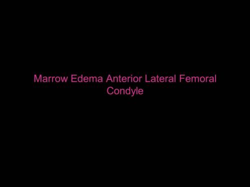Slide7