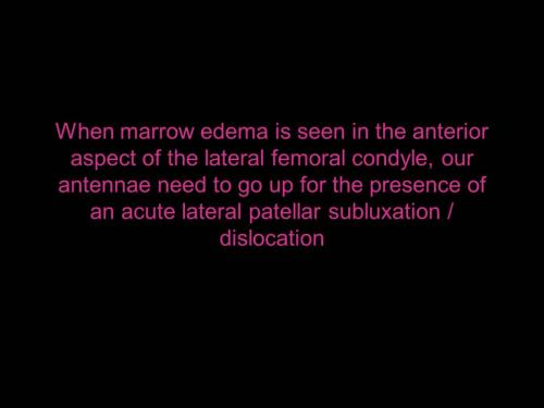 Slide8